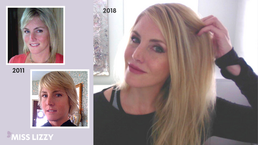 How Thyroid Medication Made My Hair Fall Out (And What I Did About It)